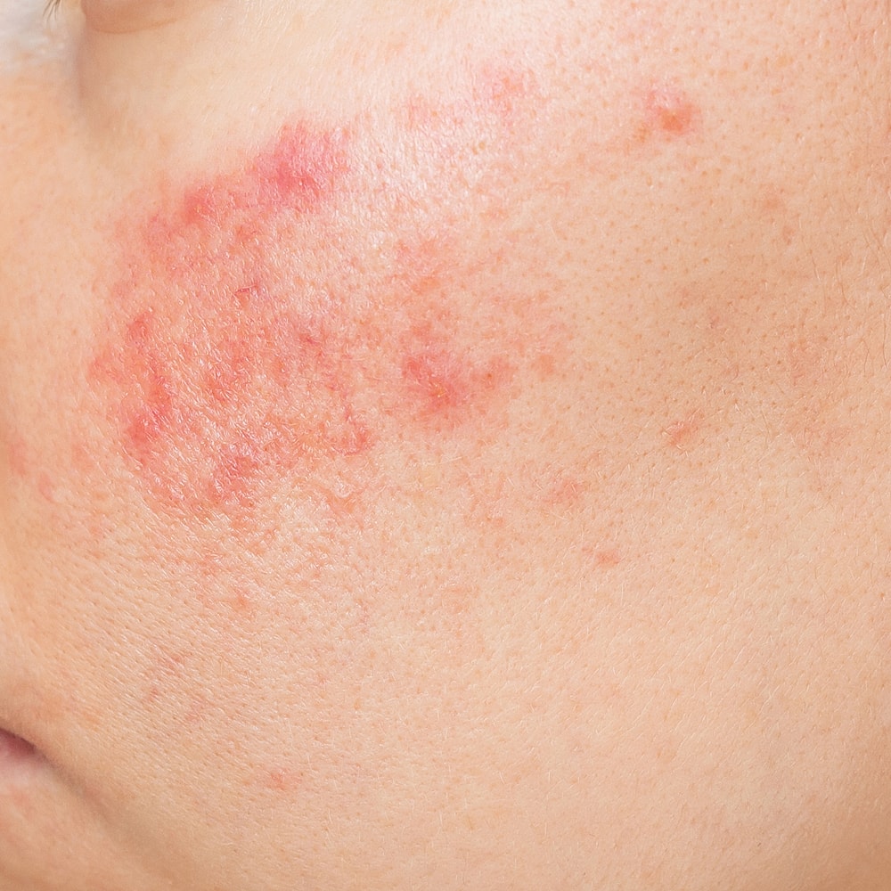 Woman with styled hair and natural makeup.