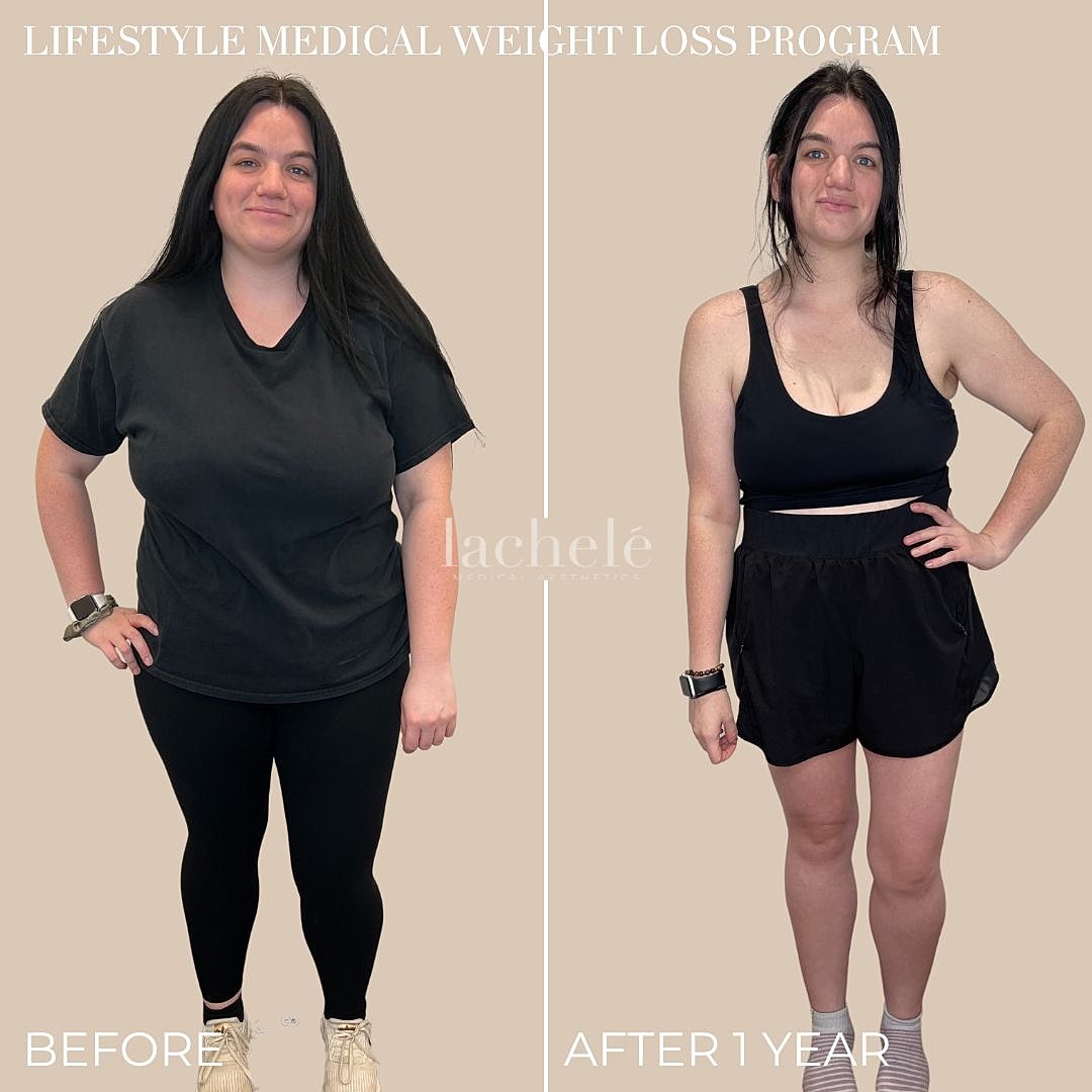 Before and after weight loss transformation photos.