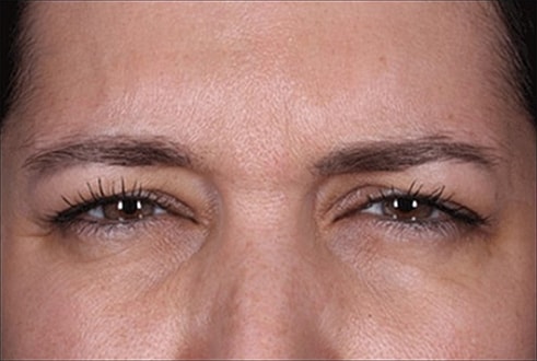 Close-up of woman’s eyes and forehead.