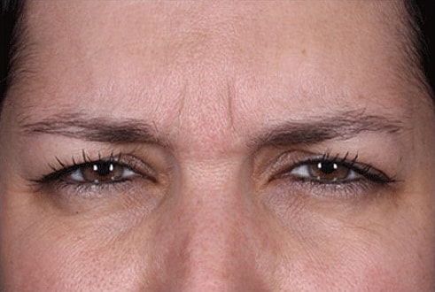 Close-up of a person's concerned facial expression.