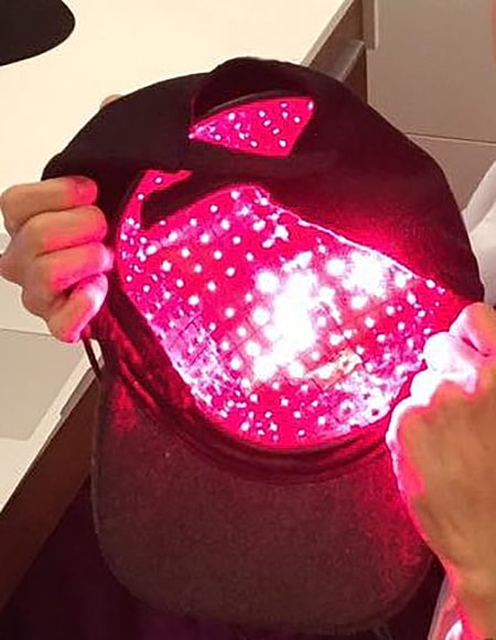 Before and after aesthetic treatment results.