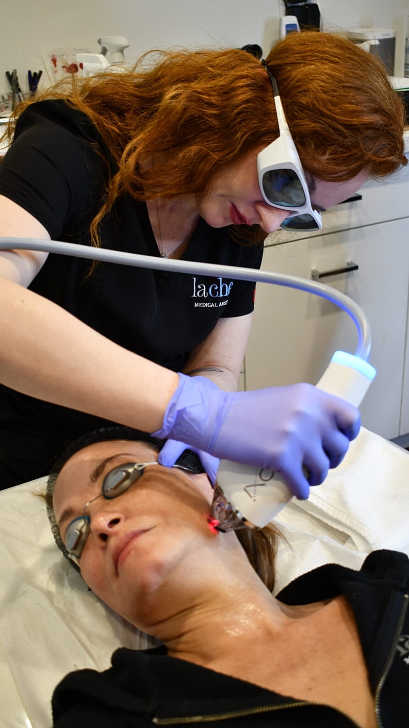 Woman receiving facial treatment with laser device.