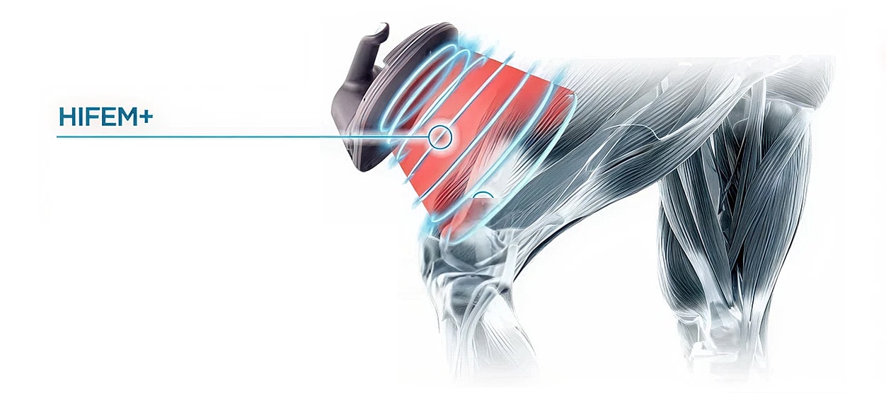 HIFEM+ technology for muscle stimulation illustration.
