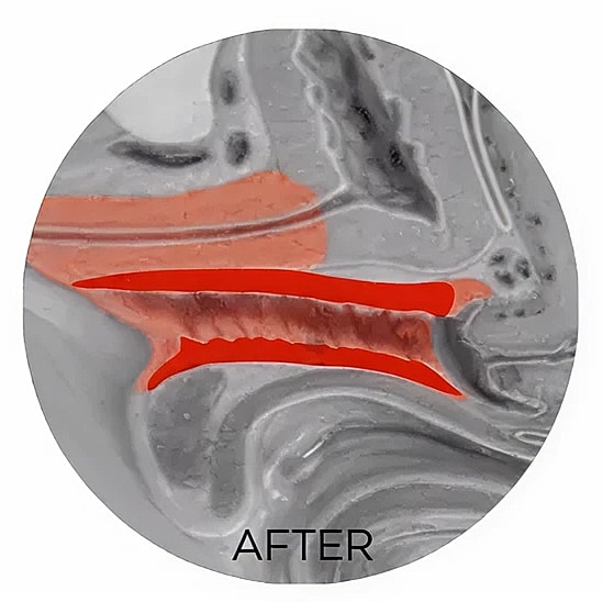 Before and after image of a structural change.
