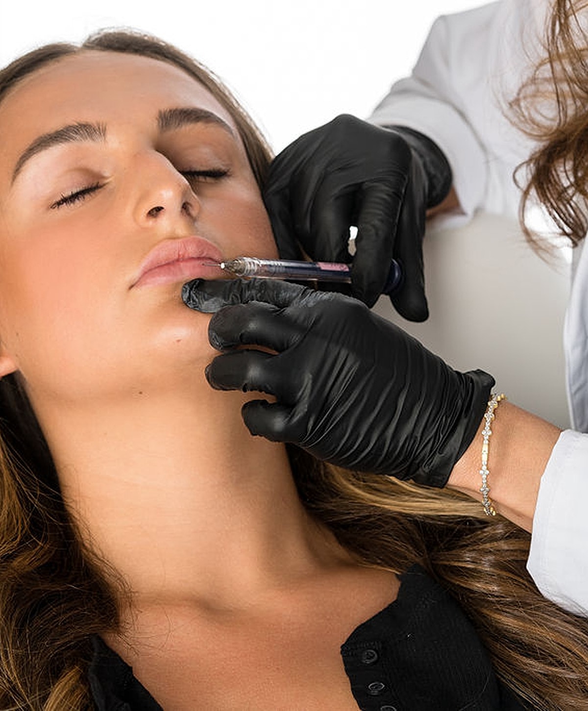 Administering lip filler treatment to a client