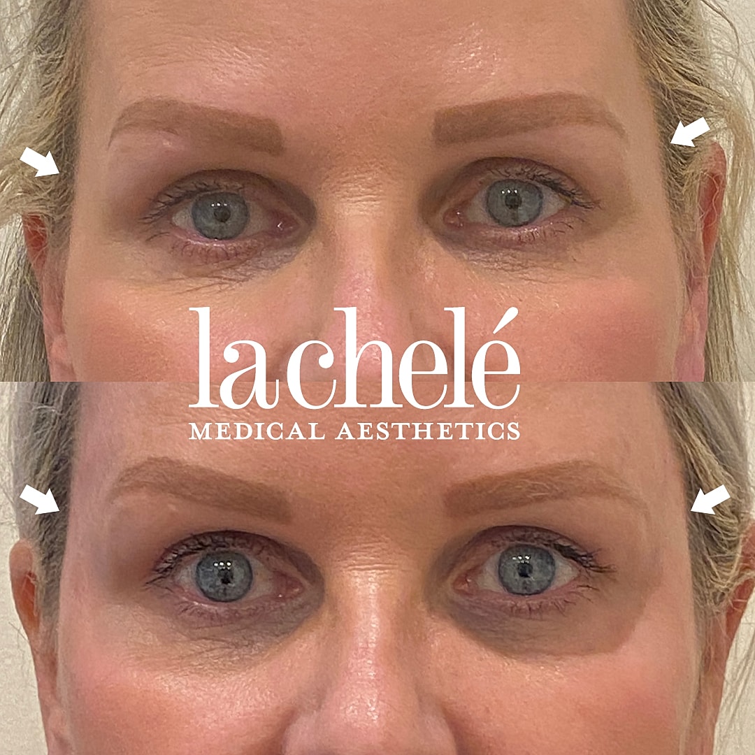 Before and after aesthetic treatment results.