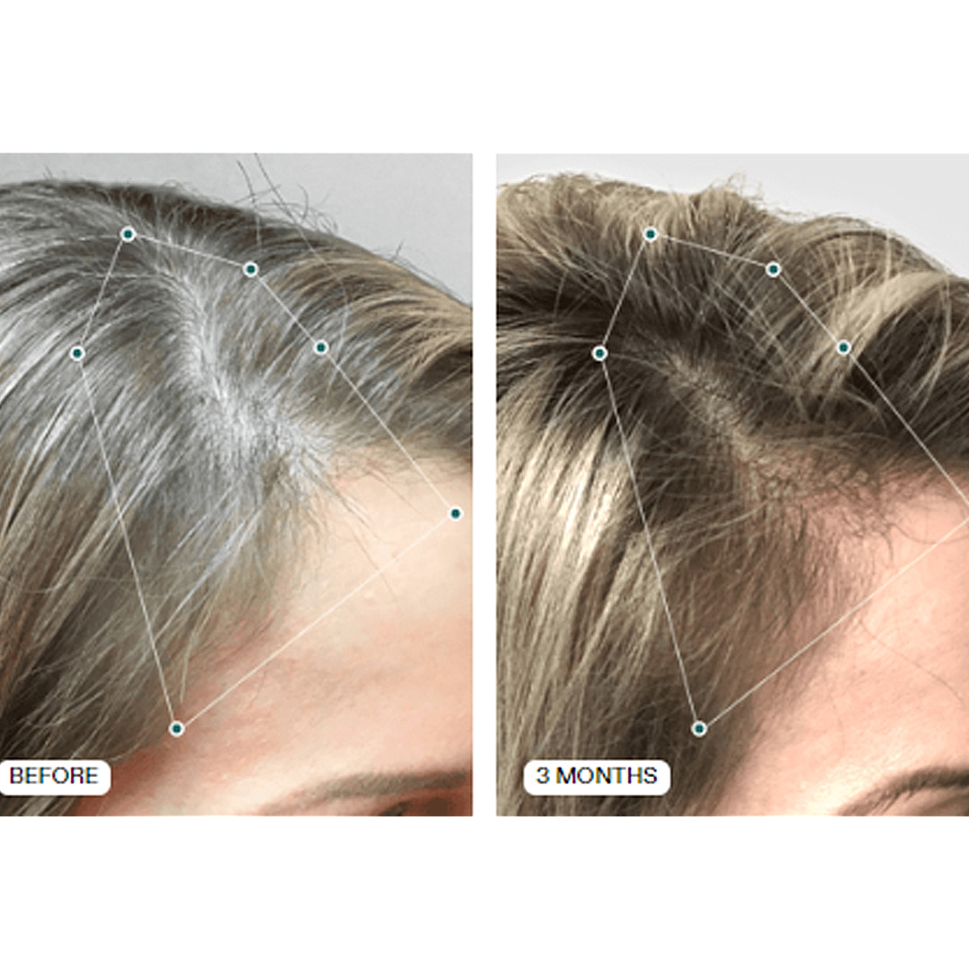 Hair transformation: before and after three months.