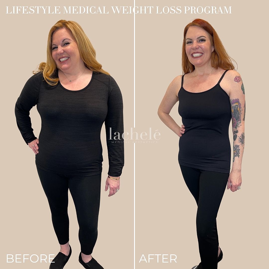 Before and after weight loss transformation photo.