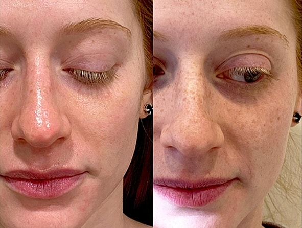 Side-by-side comparison of skin before and after.
