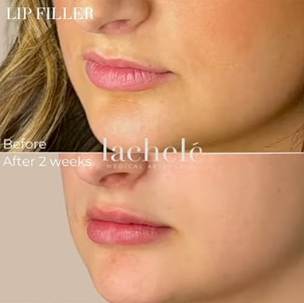 Healthcare professional in a clinical setting.