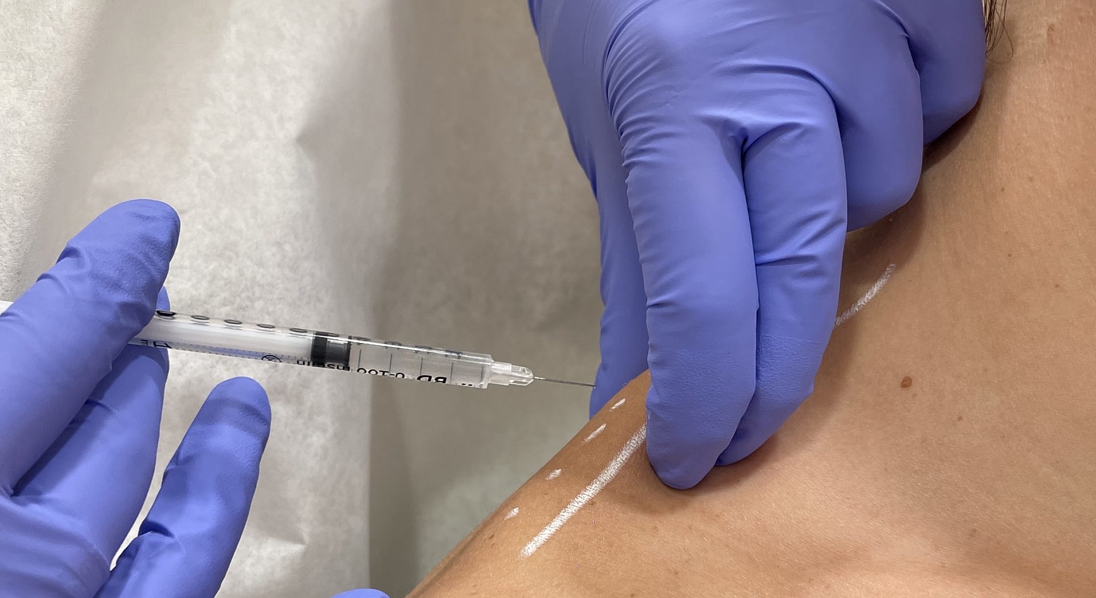 Injection procedure on a person's skin.