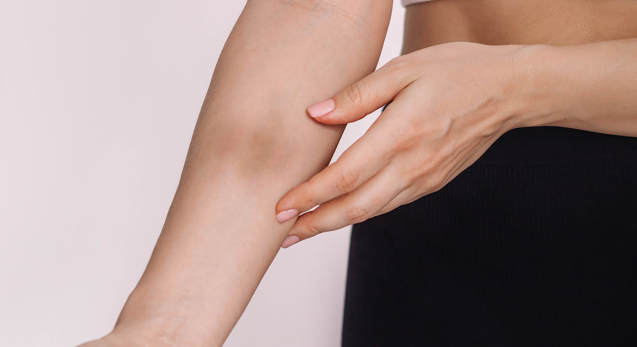 Person touching their arm with bruised skin.