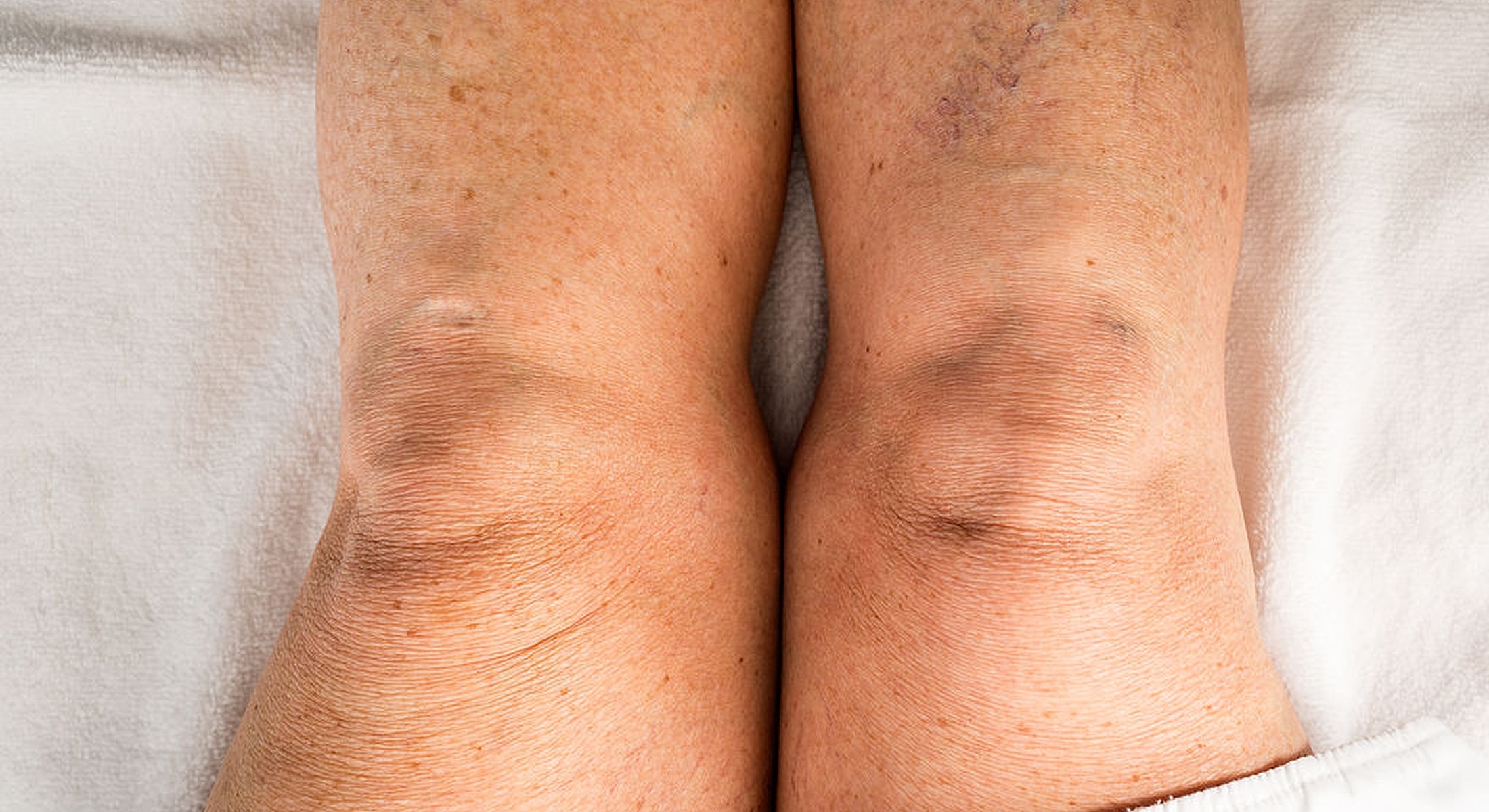 Close-up of two knees resting together.